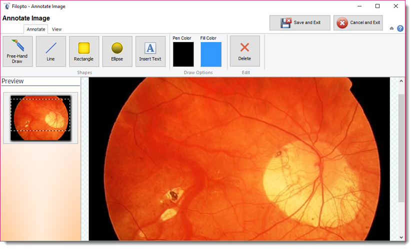 AnnotateTool
