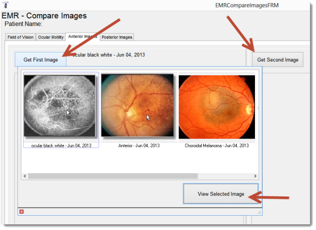ImageComparerSelect